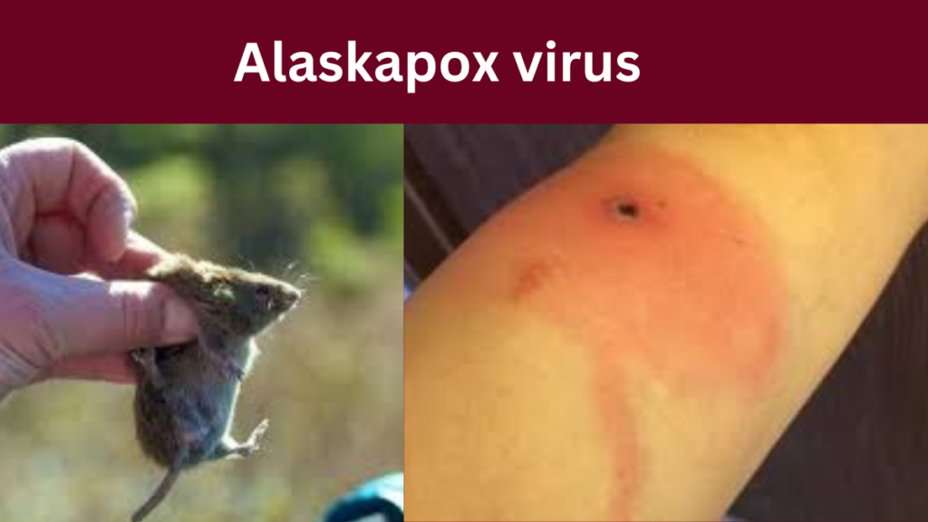 Alaskapox virus